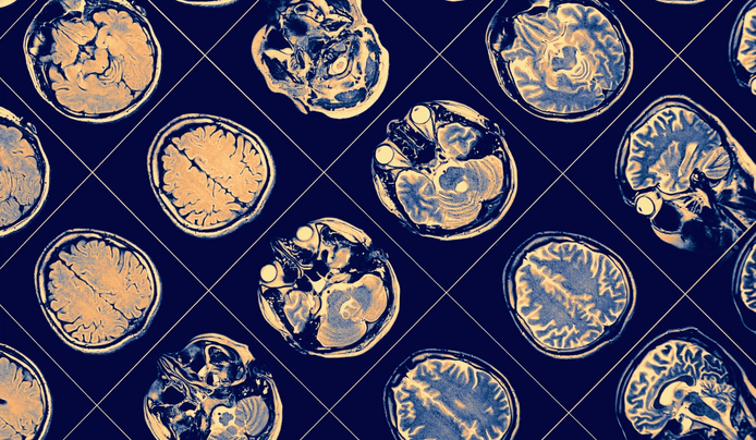 an image shows a series of brain scans arranged in a grid patter